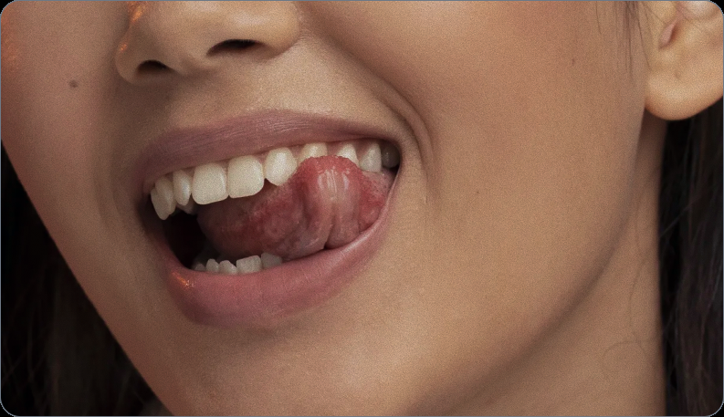 What are dentine tubules?